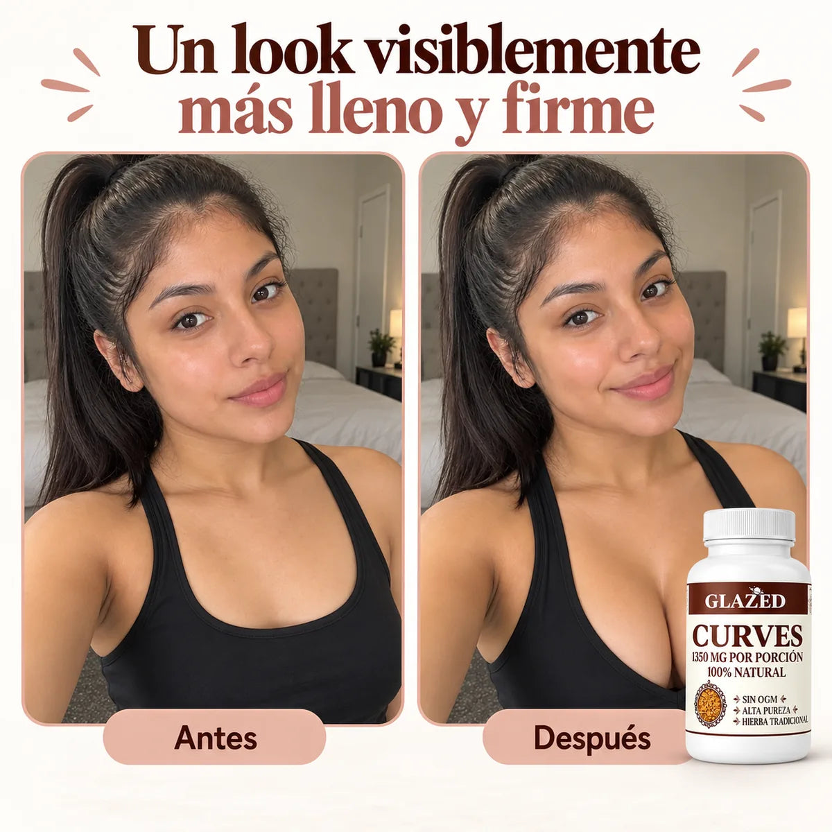 Un look visiblemente más lleno y firme · antes y después